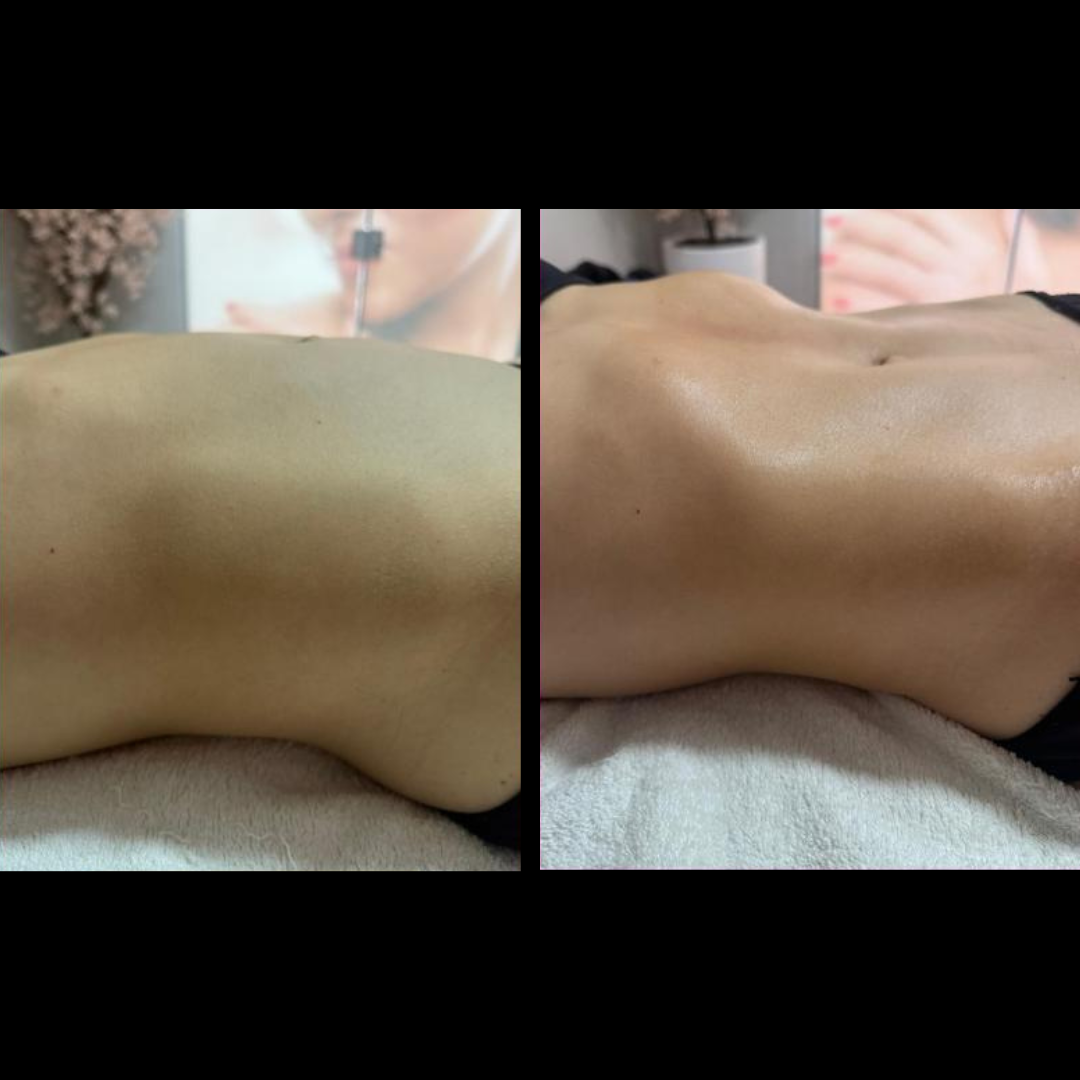 Antes e depois
